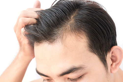 What Is The Best Treatment For Hair Growth?
