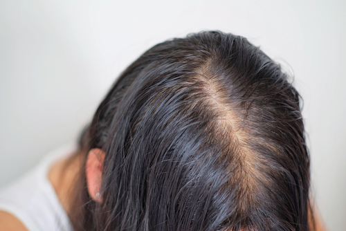 How Fast Does Our Hair Grow?