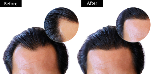 Do Vitamins for Hair Growth Work?