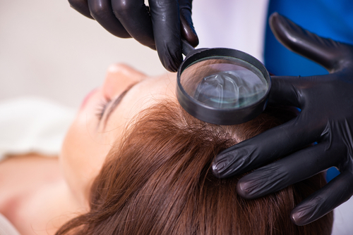 Common Myths And Misconceptions About Hair Implants