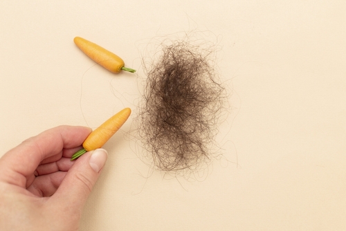 Hair loss due to poor diet
