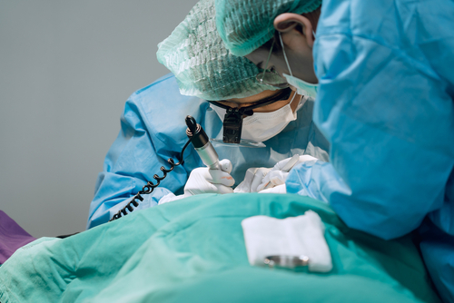 Hair Transplant Surgery